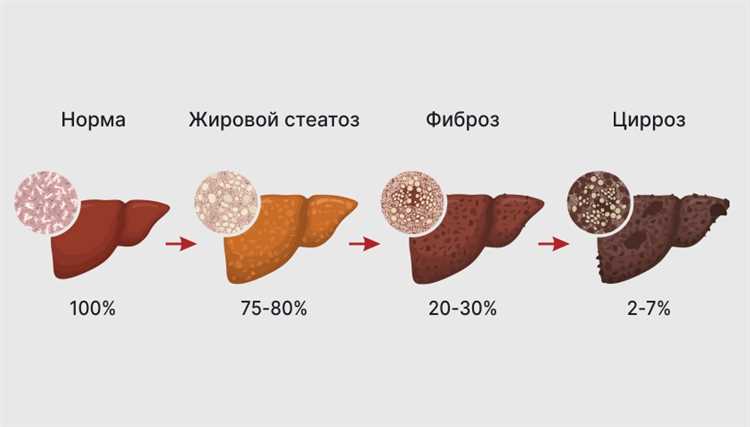 Формы недостаточности и стадии заболевания