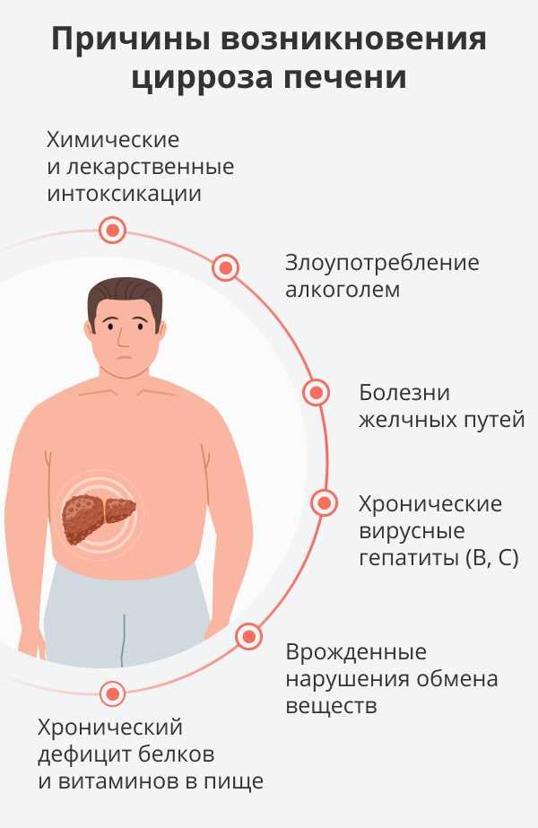 Физическая нагрузка при циррозе — важное условие для улучшения состояния пациента