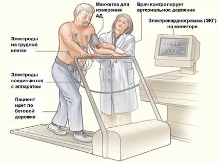 Что такое физическая нагрузка и как ее объективно измерить без искажений?