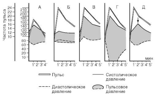 Нормотоническая реакция на физическую нагрузку — основы, механизмы и применение в тренировочном процессе для достижения максимальных результатов