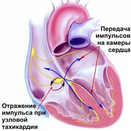 Народное лечение тахикардии