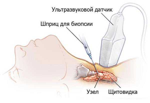 Преимущества физических нагрузок