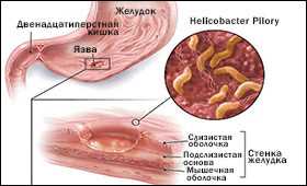 2. Режим физических нагрузок